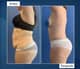 Slider image (10) Dr. Jose E. Telich - Plastic Surgeon
